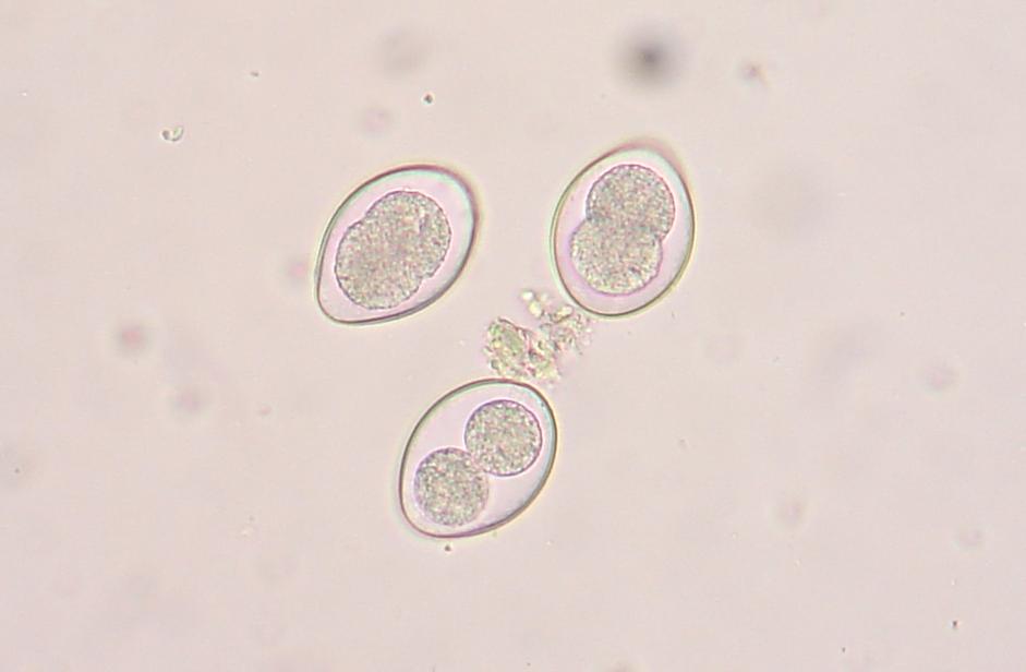 intestinal parasites