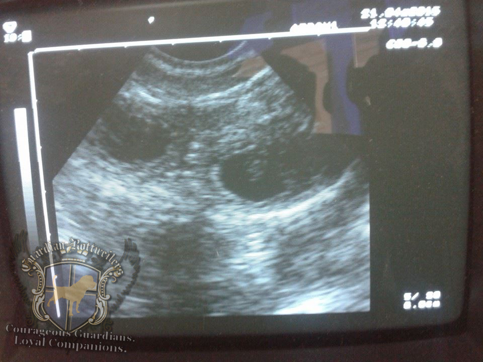 Zarabi_ultrasound01