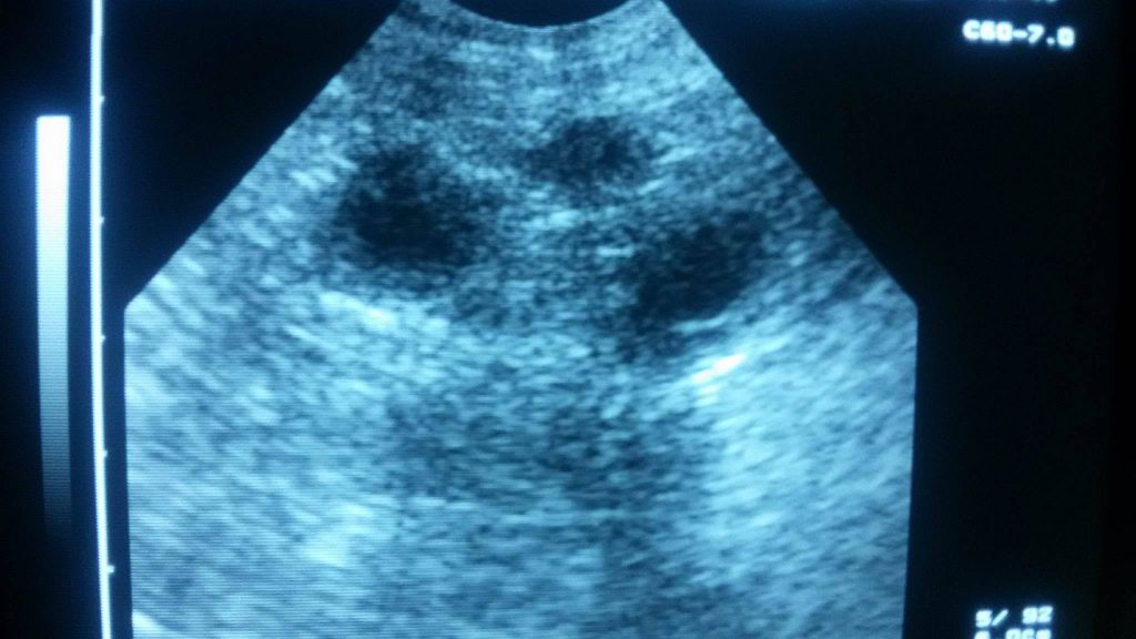 Hana_Lucky_ultrasound3